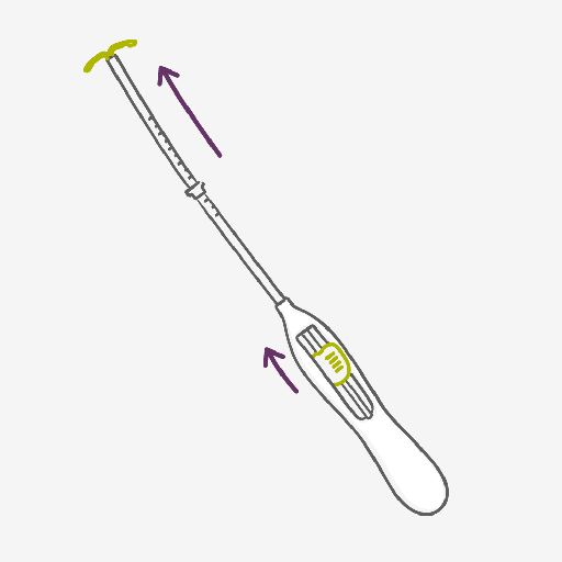 Sistema Intrauterino – Frenando en seco a los espermatozoides con el SIU Sistema Intrauterino – Frenando en seco a los espermatozoides con el SIU